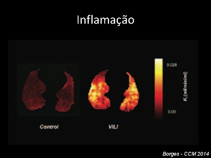 Inflamação Borges - CCM 2014 Inflamação Borges - CCM 2014