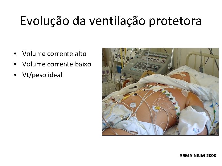Evolução da ventilação protetora • Volume corrente alto • Volume corrente baixo • Vt/peso Evolução da ventilação protetora • Volume corrente alto • Volume corrente baixo • Vt/peso