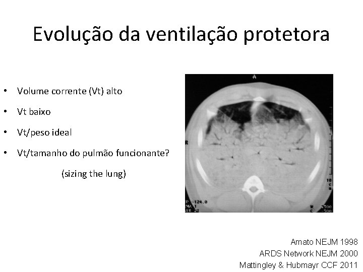 Evolução da ventilação protetora • Volume corrente (Vt) alto • Vt baixo • Vt/peso Evolução da ventilação protetora • Volume corrente (Vt) alto • Vt baixo • Vt/peso