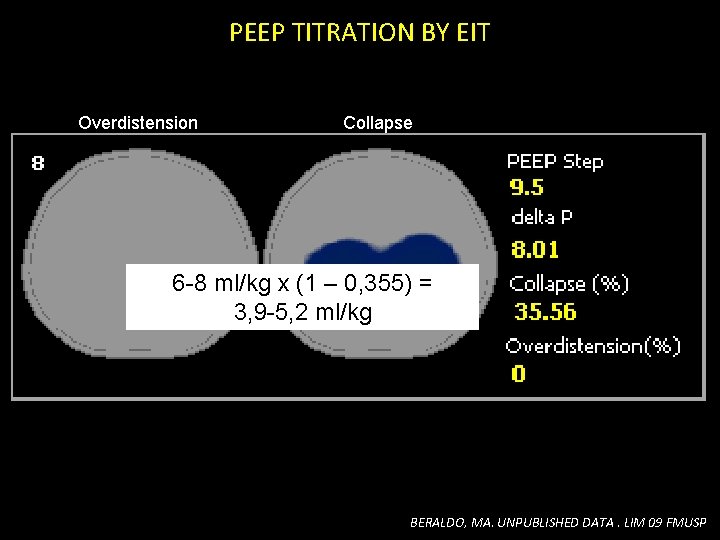 PEEP TITRATION BY EIT Overdistension Collapse 6 -8 ml/kg x (1 – 0, 355) PEEP TITRATION BY EIT Overdistension Collapse 6 -8 ml/kg x (1 – 0, 355)