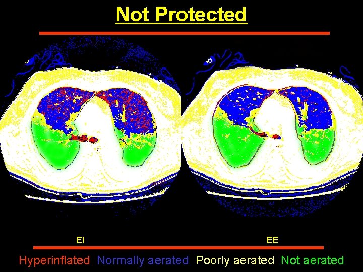Not Protected EI EE Hyperinflated Normally aerated Poorly aerated Not aerated Not Protected EI EE Hyperinflated Normally aerated Poorly aerated Not aerated