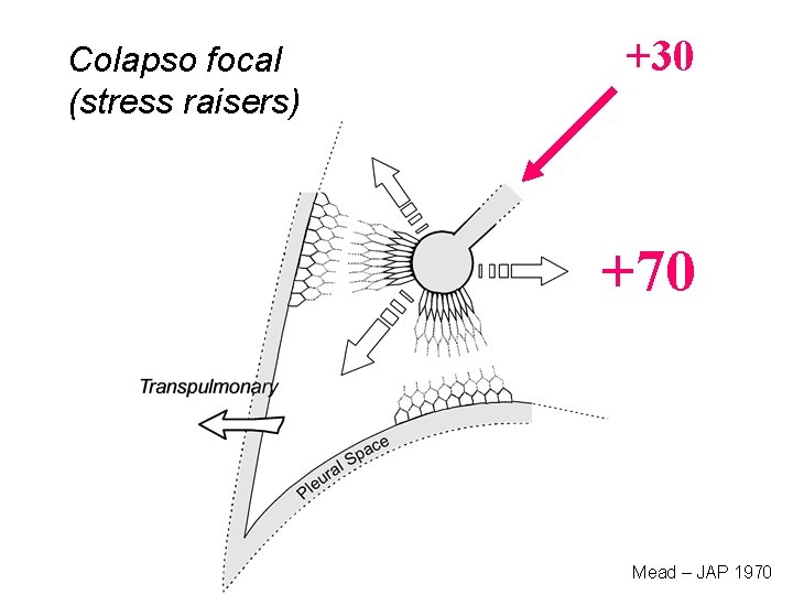 Colapso focal (stress raisers) +30 +70 Mead – JAP 1970 Colapso focal (stress raisers) +30 +70 Mead – JAP 1970