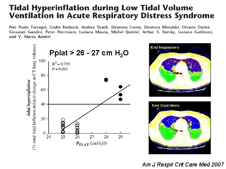 Pplat > 26 - 27 cm H 2 O Am J Respir Crit Care Pplat > 26 - 27 cm H 2 O Am J Respir Crit Care