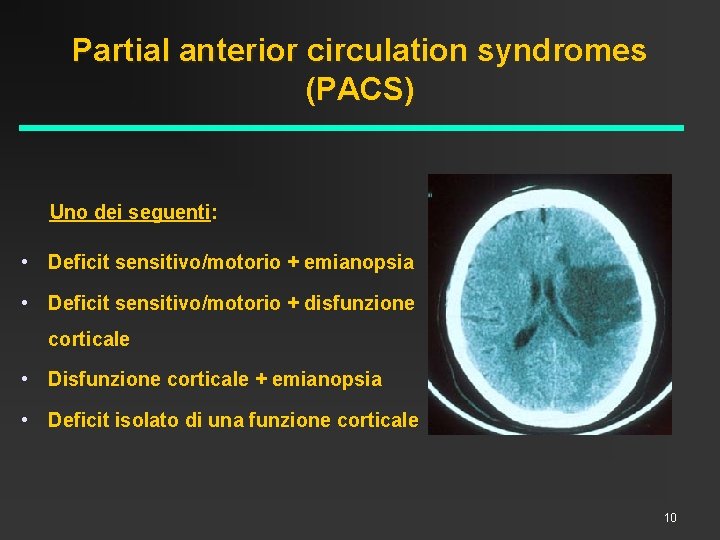 Partial anterior circulation syndromes (PACS) Uno dei seguenti: • Deficit sensitivo/motorio + emianopsia •