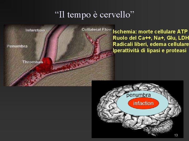 “Il tempo è cervello” Ischemia: morte cellulare ATP Ruolo del Ca++, Na+, Glu, LDH