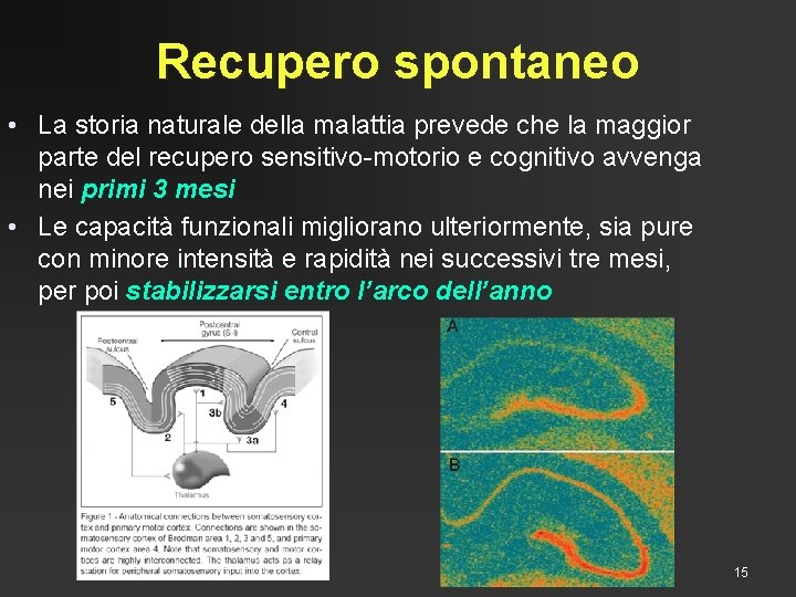 Recupero spontaneo • La storia naturale della malattia prevede che la maggior parte del