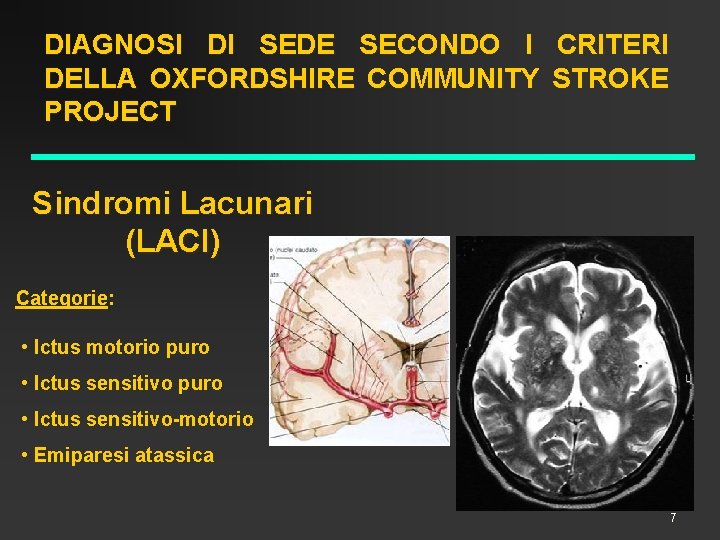 DIAGNOSI DI SEDE SECONDO I CRITERI DELLA OXFORDSHIRE COMMUNITY STROKE PROJECT Sindromi Lacunari (LACI)