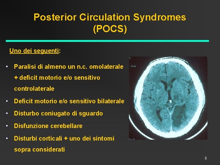 Posterior Circulation Syndromes (POCS) Uno dei seguenti: • Paralisi di almeno un n. c.