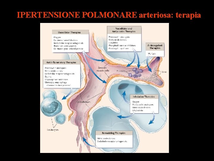 IPERTENSIONE POLMONARE arteriosa: terapia 