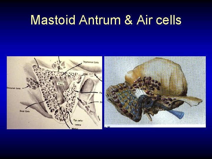 Mastoid Antrum & Air cells 