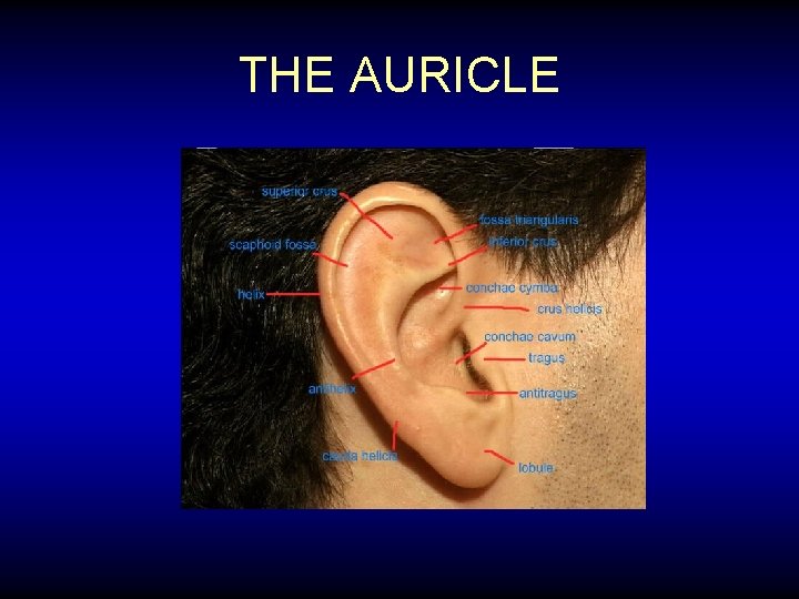 THE AURICLE 