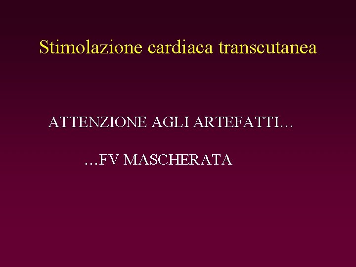 Stimolazione cardiaca transcutanea ATTENZIONE AGLI ARTEFATTI… …FV MASCHERATA 