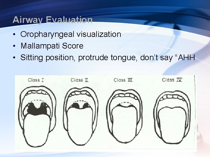 Airway Evaluation • Oropharyngeal visualization • Mallampati Score • Sitting position, protrude tongue, don’t