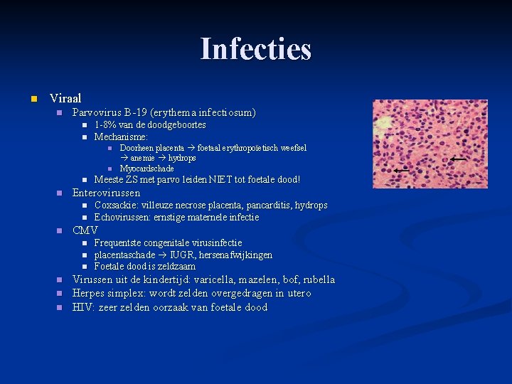 Infecties n Viraal n Parvovirus B-19 (erythema infectiosum) n n 1 -8% van de Infecties n Viraal n Parvovirus B-19 (erythema infectiosum) n n 1 -8% van de