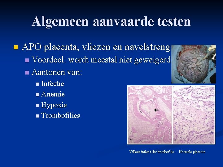 Algemeen aanvaarde testen n APO placenta, vliezen en navelstreng Voordeel: wordt meestal niet geweigerd Algemeen aanvaarde testen n APO placenta, vliezen en navelstreng Voordeel: wordt meestal niet geweigerd