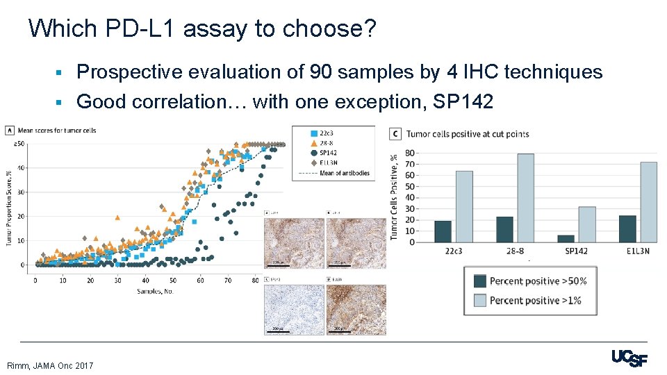 Which PD-L 1 assay to choose? Prospective evaluation of 90 samples by 4 IHC