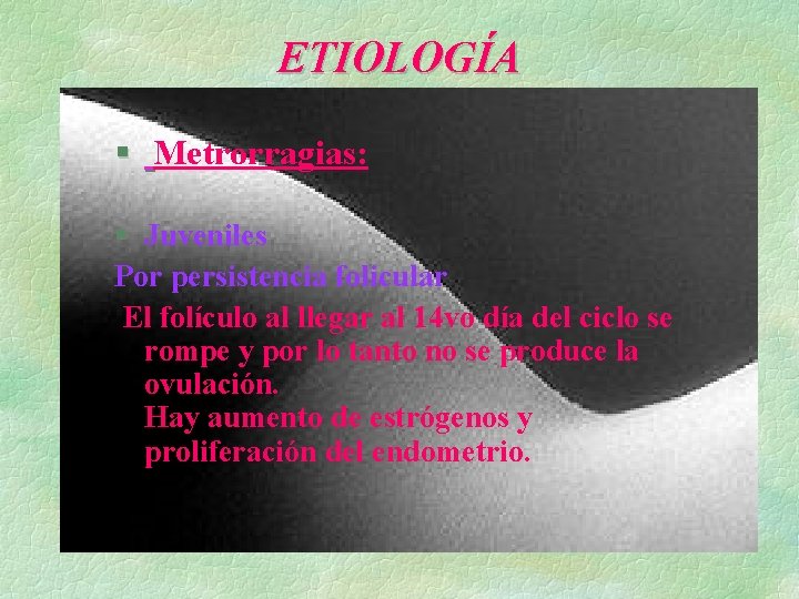 ETIOLOGÍA § Metrorragias: § Juveniles Por persistencia folicular. El folículo al llegar al 14