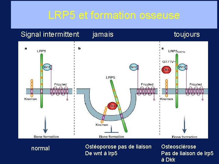 LRP 5 et formation osseuse Signal intermittent normal jamais Ostéoporose pas de liaison De