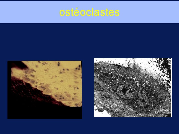 ostéoclastes 