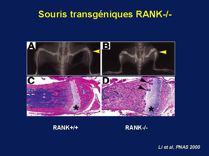 Souris transgéniques RANK-/- RANK+/+ RANK-/Li et al, PNAS 2000 