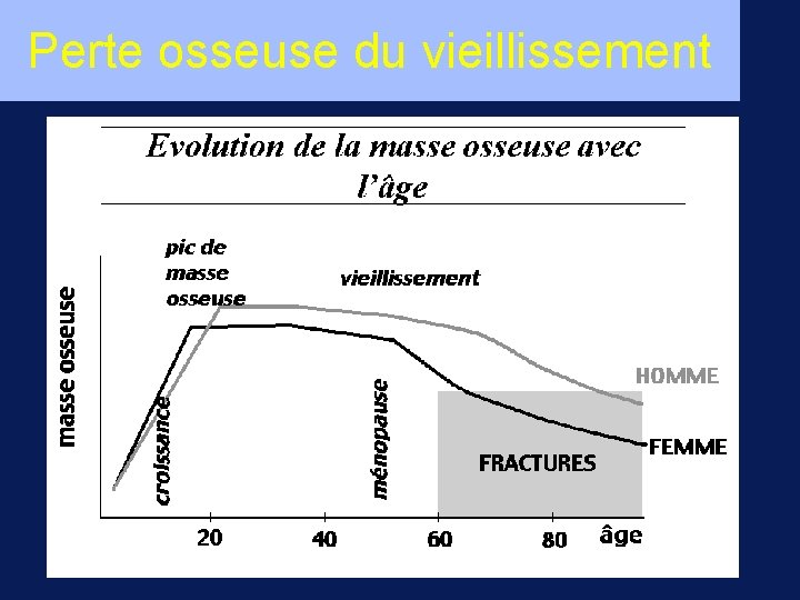 Perte osseuse du vieillissement 