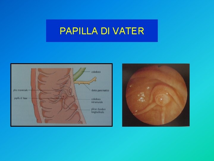 PAPILLA DI VATER 