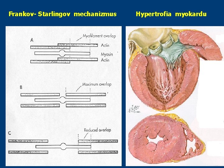 Frankov- Starlingov mechanizmus Hypertrofia myokardu Frankov- Starlingov mechanizmus Hypertrofia myokardu