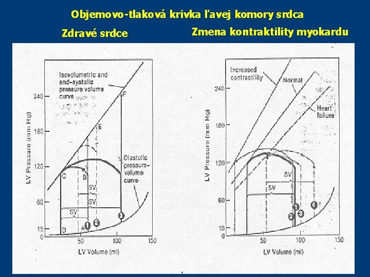 Objemovo-tlaková krivka ľavej komory srdca Zdravé srdce Zmena kontraktility myokardu Objemovo-tlaková krivka ľavej komory srdca Zdravé srdce Zmena kontraktility myokardu