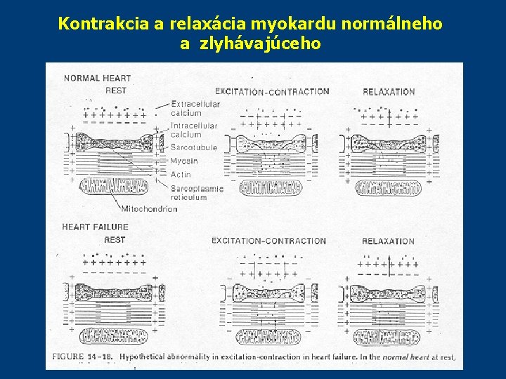 Kontrakcia a relaxácia myokardu normálneho a zlyhávajúceho Kontrakcia a relaxácia myokardu normálneho a zlyhávajúceho