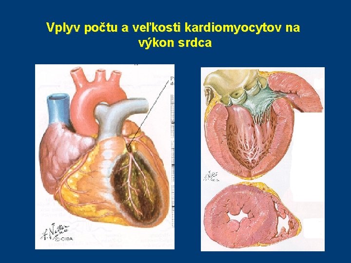 Vplyv počtu a veľkosti kardiomyocytov na výkon srdca Vplyv počtu a veľkosti kardiomyocytov na výkon srdca