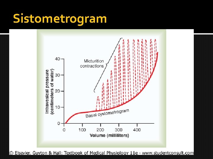 Sistometrogram 