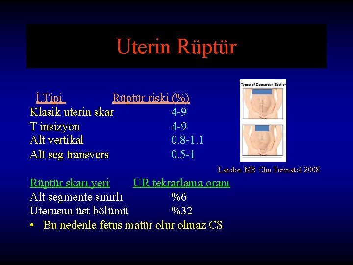 Uterin Rüptür İ. Tipi Rüptür riski (%) Klasik uterin skar 4 -9 T insizyon Uterin Rüptür İ. Tipi Rüptür riski (%) Klasik uterin skar 4 -9 T insizyon