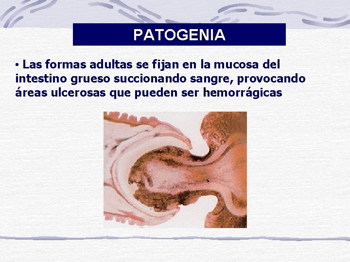 PATOGENIA • Las formas adultas se fijan en la mucosa del intestino grueso succionando