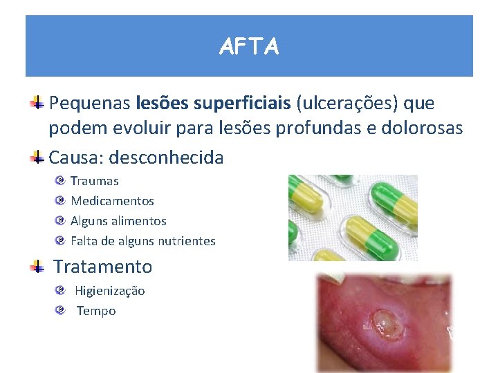 AFTA Pequenas lesões superficiais (ulcerações) que podem evoluir para lesões profundas e dolorosas Causa: