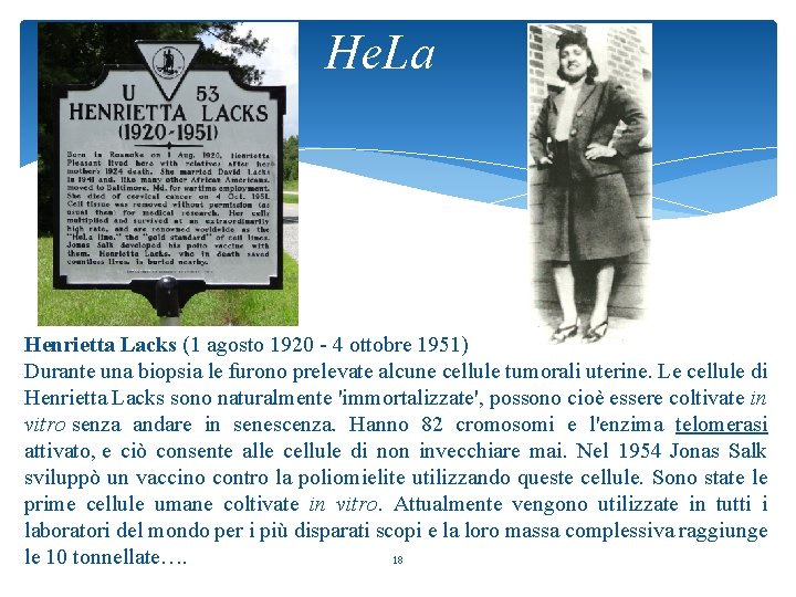 He. La Henrietta Lacks (1 agosto 1920 - 4 ottobre 1951) Durante una biopsia