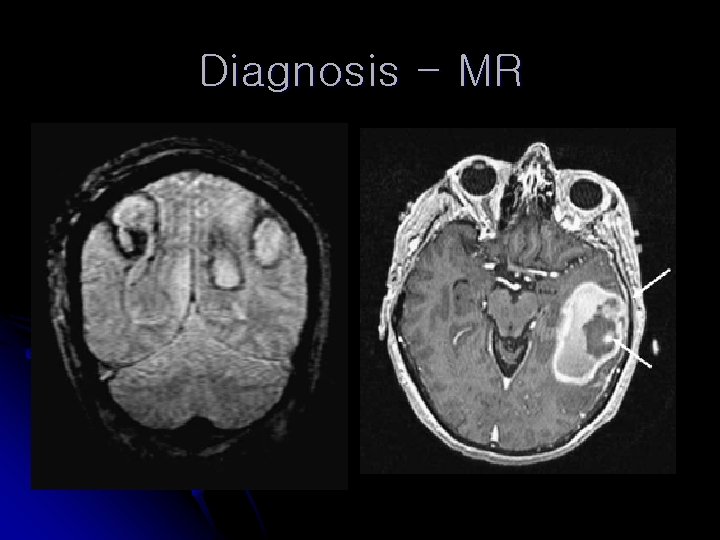 Diagnosis - MR 