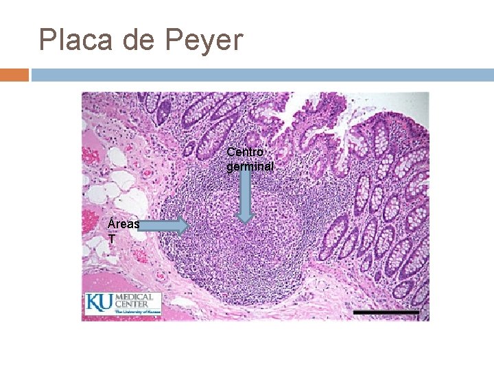 Placa de Peyer Centro germinal Áreas T Placa de Peyer Centro germinal Áreas T
