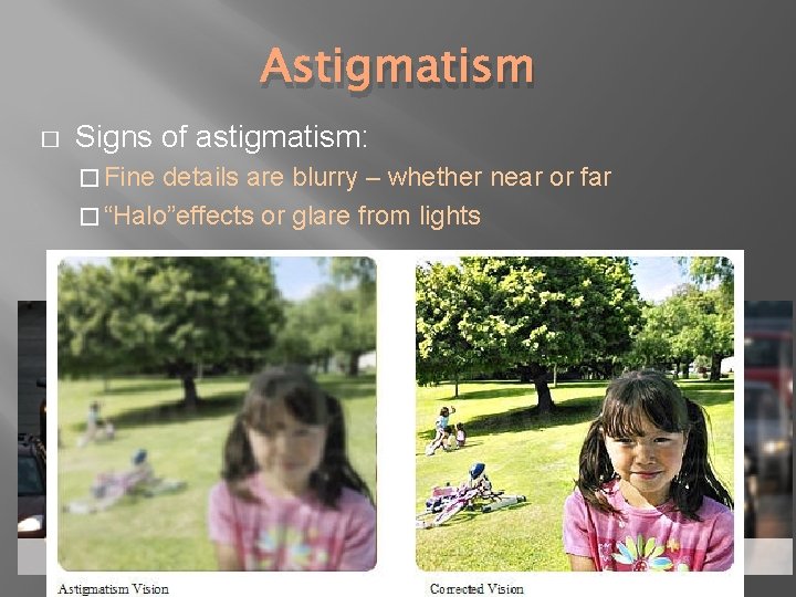 Astigmatism � Signs of astigmatism: � Fine details are blurry – whether near or