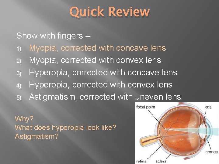 Quick Review Show with fingers – 1) Myopia, corrected with concave lens 2) Myopia,