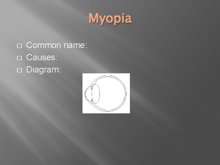 Myopia � � � Common name: Causes: Diagram: 