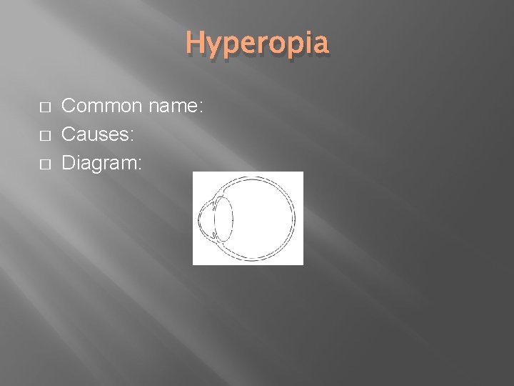 Hyperopia � � � Common name: Causes: Diagram: 