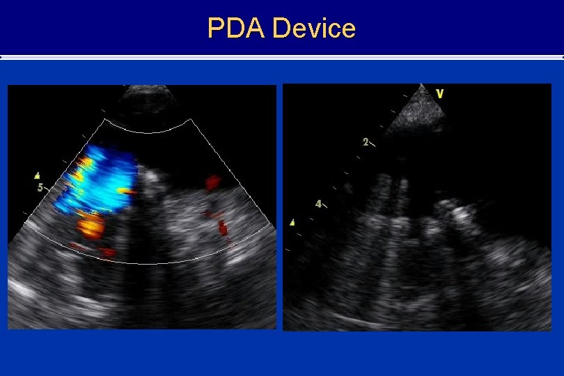 PDA Device 