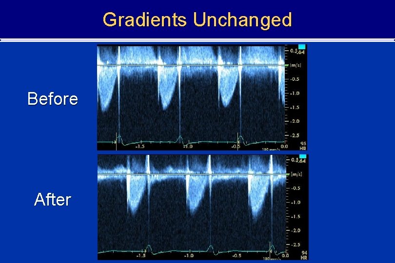 Gradients Unchanged Before After 