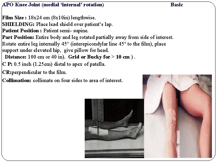 APO Knee Joint (medial ‘internal’ rotation) Basic Film Size : 18 x 24 cm