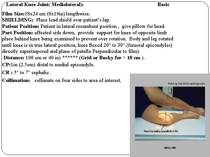 Lateral Knee Joint( Mediolateral): Basic Film Size: 18 x 24 cm (8 x 10