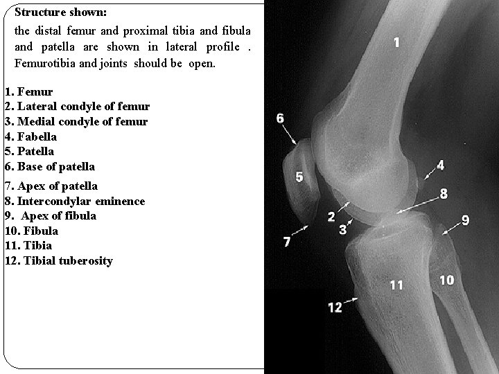 Structure shown: the distal femur and proximal tibia and fibula and patella are shown