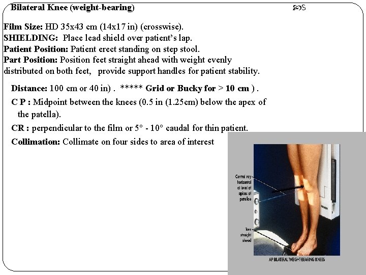 Bilateral Knee (weight-bearing) Film Size: HD 35 x 43 cm (14 x 17 in)