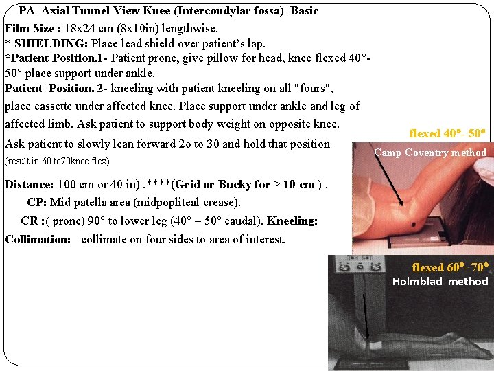 PA Axial Tunnel View Knee (Intercondylar fossa) Basic Film Size : 18 x 24