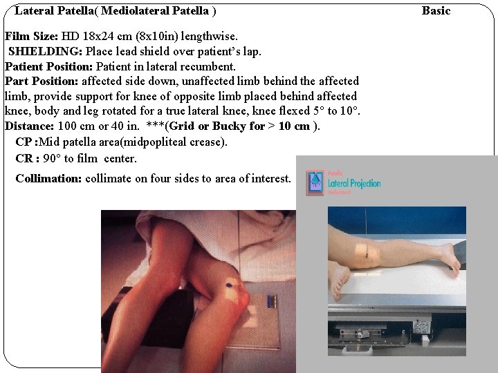 Lateral Patella( Mediolateral Patella ) Film Size: HD 18 x 24 cm (8 x