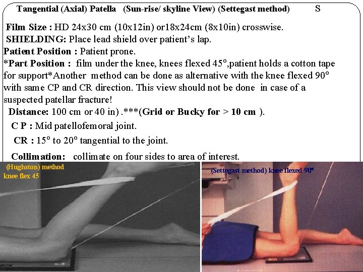 Tangential (Axial) Patella (Sun-rise/ skyline View) (Settegast method) S Film Size : HD 24